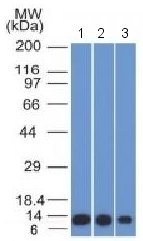 Western blot - Anti-S100A4 antibody [S100A4/1482] (ab218512), expandable thumbnail