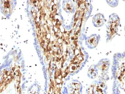 Immunohistochemistry (Formalin/PFA-fixed paraffin-embedded sections) - Anti-S100A4 antibody [S100A4/1482] - BSA and Azide free (AB218954)