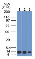 Western blot - Anti-S100A4 antibody [S100A4/1482] - BSA and Azide free (AB218954)
