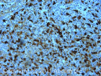 Immunohistochemistry (Formalin/PFA-fixed paraffin-embedded sections) - Anti-S100A8 antibody [2C5/4] (AB19860)