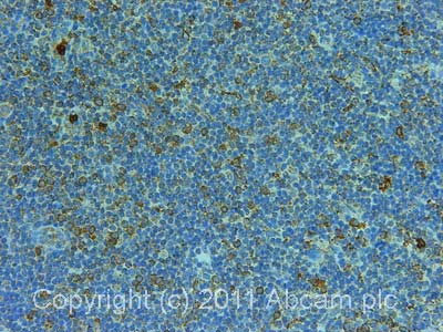 Immunohistochemistry (Formalin/PFA-fixed paraffin-embedded sections) - Anti-S100A8 antibody [7C12/4] (AB20220)