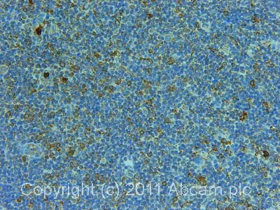 Immunohistochemistry (Formalin/PFA-fixed paraffin-embedded sections) - Anti-S100A8 antibody [7C12/4] (AB20220)