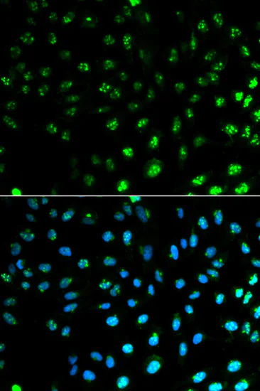 Immunocytochemistry/ Immunofluorescence - Anti-S100A8 antibody (AB180735)