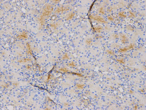 Immunohistochemistry (Formalin/PFA-fixed paraffin-embedded sections) - Anti-S100A8 antibody (AB180735)