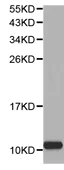 Western blot - Anti-S100A8 antibody (AB180735)