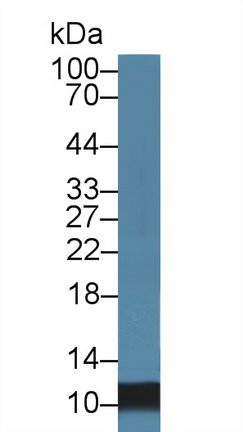 Western blot - Anti-S100A8 antibody (AB231215)