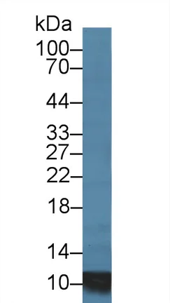 Western blot - Anti-S100A8 antibody (AB231215)