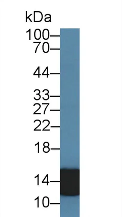 Western blot - Anti-S100A8 antibody (AB231215)