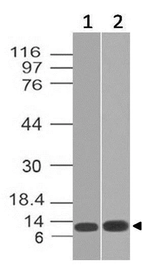 Western blot - Anti-S100A8 antibody [ABM4A69] (AB220174)