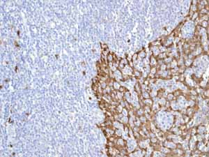 Immunohistochemistry (Formalin/PFA-fixed paraffin-embedded sections) - Anti-S100A8 antibody [EPR3554] (ab92331), expandable thumbnail