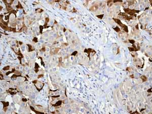 Immunohistochemistry (Formalin/PFA-fixed paraffin-embedded sections) - Anti-S100A8 antibody [EPR3554] (ab92331), expandable thumbnail