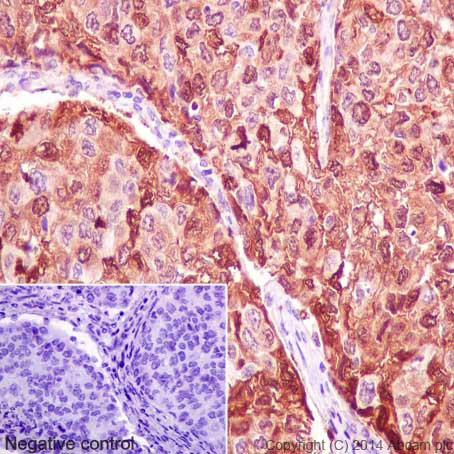 Immunohistochemistry (Formalin/PFA-fixed paraffin-embedded sections) - Anti-S100A8 antibody [EPR3554] (AB92331), expandable thumbnail