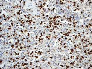 Immunohistochemistry (Formalin/PFA-fixed paraffin-embedded sections) - Anti-S100A8 antibody [EPR3554] (ab92331), expandable thumbnail