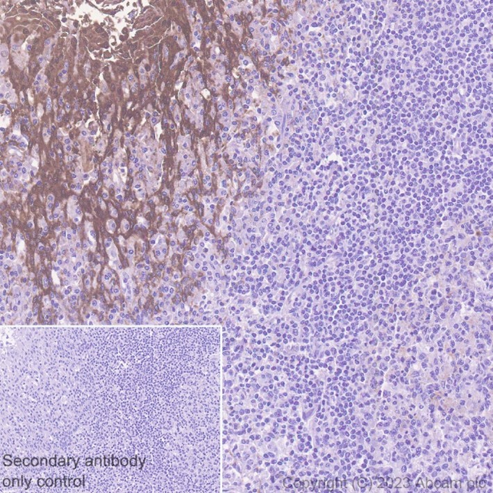 Immunohistochemistry - Anti-S100A8 antibody [EPR3554] (AB92331)