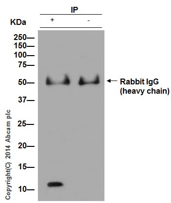 Immunoprecipitation - Anti-S100A8 antibody [EPR3554] (AB92331), expandable thumbnail