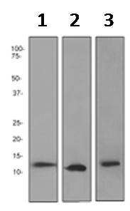 Western blot - Anti-S100A8 antibody [EPR3554] (ab92331), expandable thumbnail