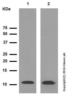 Western blot - Anti-S100A8 antibody [EPR3554] (AB92331), expandable thumbnail