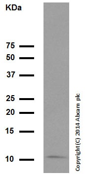 Western blot - Anti-S100A8 antibody [EPR3554] (AB92331), expandable thumbnail
