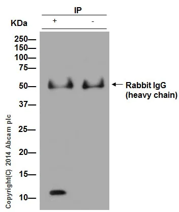 Immunoprecipitation - Anti-S100A8 antibody [EPR3554] - BSA and Azide free (AB271863)