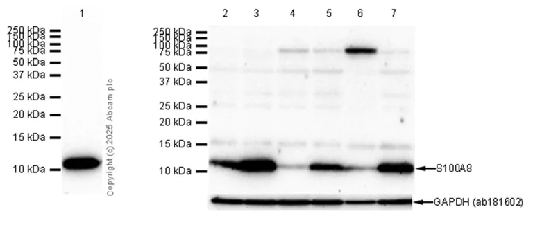 Western blot - Anti-S100A8 antibody [EPR3554] - BSA and Azide free (AB271863)