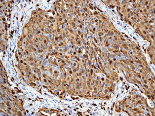 Immunohistochemistry (Formalin/PFA-fixed paraffin-embedded sections) - Anti-S100A8 antibody [EPR3554] - Low endotoxin, Azide free (AB219370)