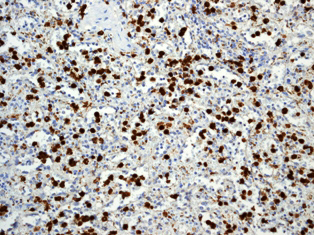 Immunohistochemistry (Formalin/PFA-fixed paraffin-embedded sections) - Anti-S100A8 antibody [EPR3554] - Low endotoxin, Azide free (AB219370)