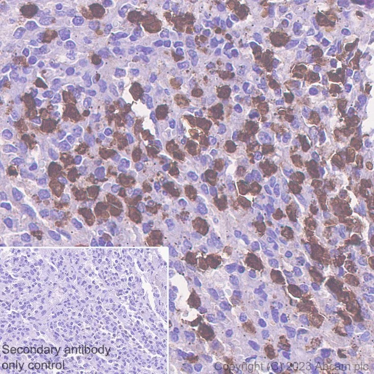 Immunohistochemistry (Formalin/PFA-fixed paraffin-embedded sections) - Anti-S100A8 antibody [EPR3554] - Low endotoxin, Azide free (AB219370)