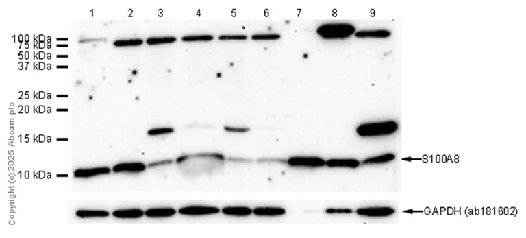 Western blot - Anti-S100A8 antibody [EPR3554] - Low endotoxin, Azide free (AB219370)
