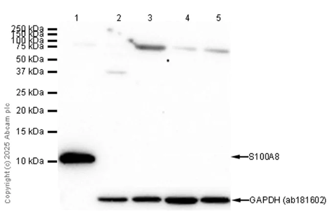Western blot - Anti-S100A8 antibody [EPR3554] - Low endotoxin, Azide free (AB219370)