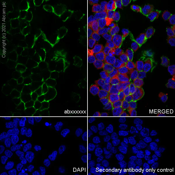 Immunocytochemistry/ Immunofluorescence - Anti-S100A8 + S100A9 antibody [RM1038] (AB288715)