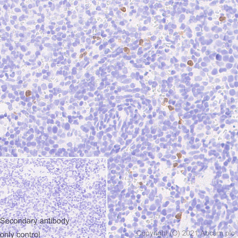 Immunohistochemistry (Formalin/PFA-fixed paraffin-embedded sections) - Anti-S100A8 + S100A9 antibody [RM1038] (AB288715)