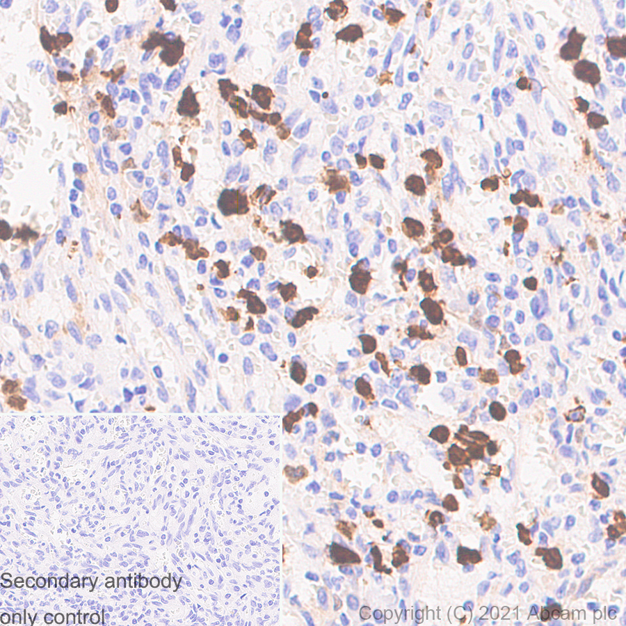 Immunohistochemistry (Formalin/PFA-fixed paraffin-embedded sections) - Anti-S100A8 + S100A9 antibody [RM1038] (AB288715)