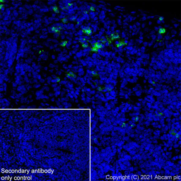 Immunohistochemistry (Frozen sections) - Anti-S100A8 + S100A9 antibody [RM1038] (AB288715)