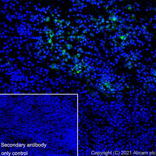 Immunohistochemistry (Frozen sections) - Anti-S100A8 + S100A9 antibody [RM1038] (AB288715)