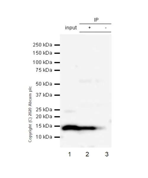 Immunoprecipitation - Anti-S100A8 + S100A9 antibody [RM1038] (AB288715)