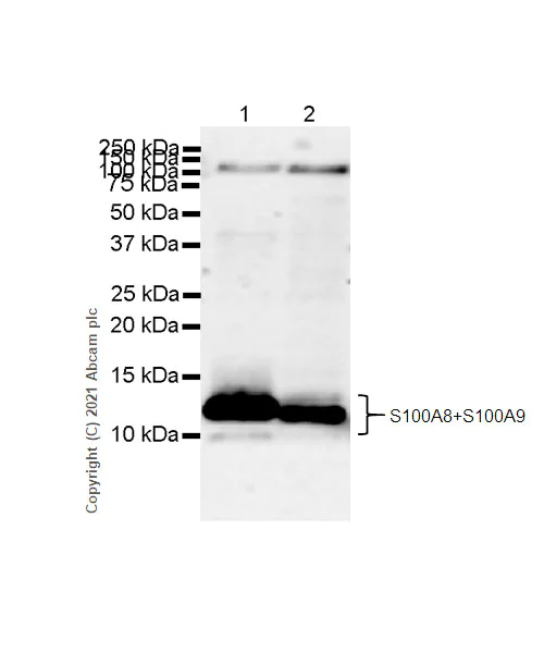 Western blot - Anti-S100A8 + S100A9 antibody [RM1038] (AB288715)