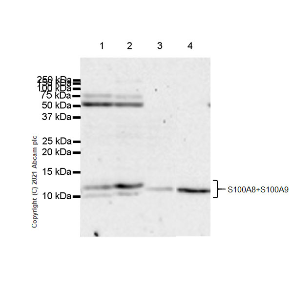 Western blot - Anti-S100A8 + S100A9 antibody [RM1038] (AB288715)