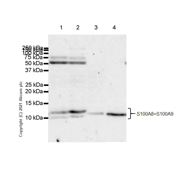 Western blot - Anti-S100A8 + S100A9 antibody [RM1038] (AB288715)