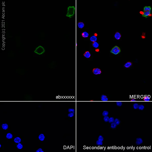 Immunocytochemistry/ Immunofluorescence - Anti-S100A8 + S100A9 antibody [RM1038] - BSA and Azide free (AB288578)