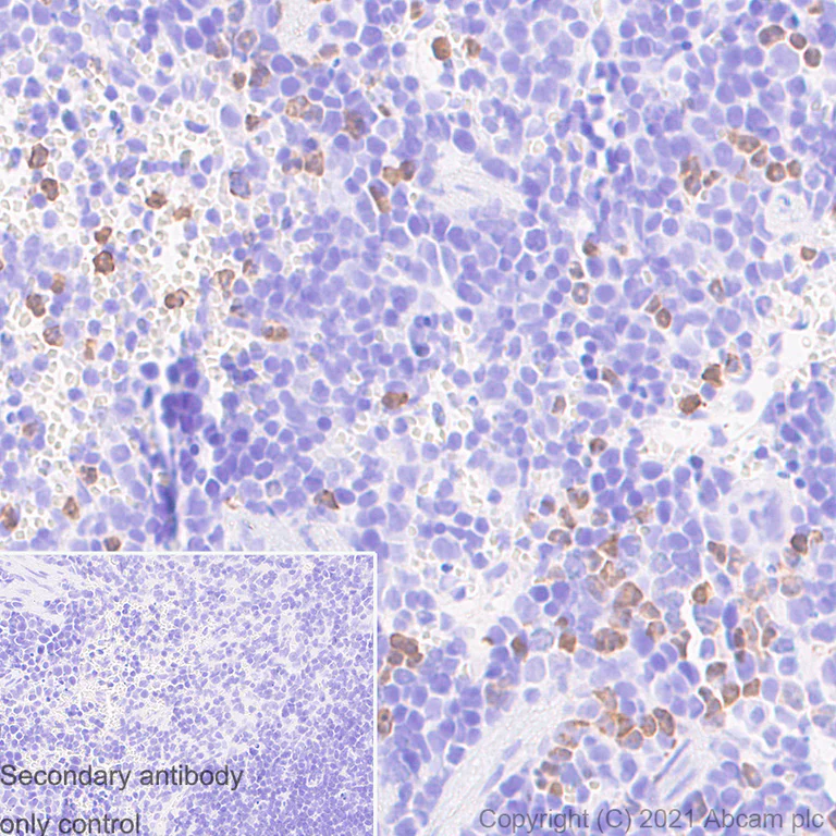 Immunohistochemistry (Formalin/PFA-fixed paraffin-embedded sections) - Anti-S100A8 + S100A9 antibody [RM1038] - BSA and Azide free (AB288578)