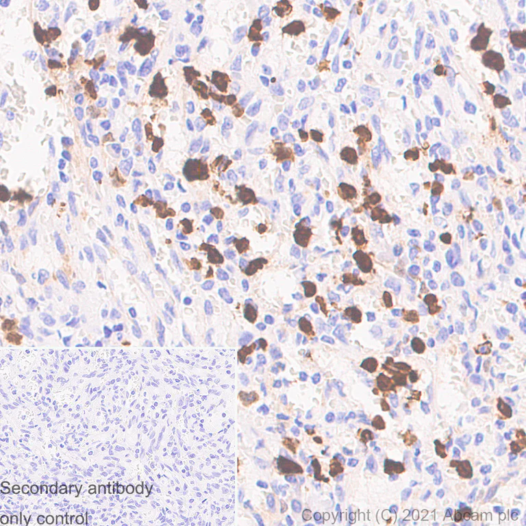Immunohistochemistry (Formalin/PFA-fixed paraffin-embedded sections) - Anti-S100A8 + S100A9 antibody [RM1038] - BSA and Azide free (AB288578)