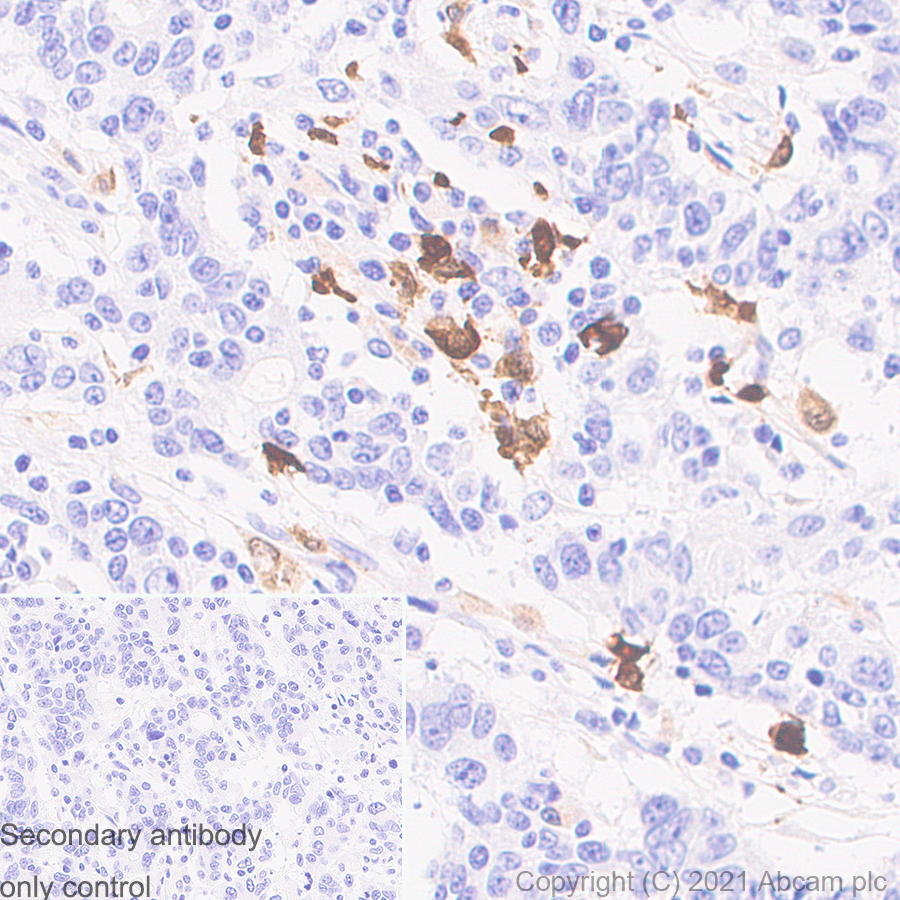 Immunohistochemistry (Formalin/PFA-fixed paraffin-embedded sections) - Anti-S100A8 + S100A9 antibody [RM1038] - BSA and Azide free (AB288578)