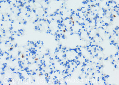 Immunohistochemistry (Formalin/PFA-fixed paraffin-embedded sections) - Anti-S100A9 antibody [2B10] (AB105472), expandable thumbnail