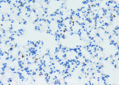 Immunohistochemistry (Formalin/PFA-fixed paraffin-embedded sections) - Anti-S100A9 antibody [2B10] (AB105472)
