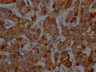 Immunohistochemistry (Formalin/PFA-fixed paraffin-embedded sections) - Anti-S100A9 antibody [2E9] (AB302946)