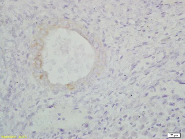 Immunohistochemistry (Formalin/PFA-fixed paraffin-embedded sections) - Anti-S100A9 antibody (AB203133)