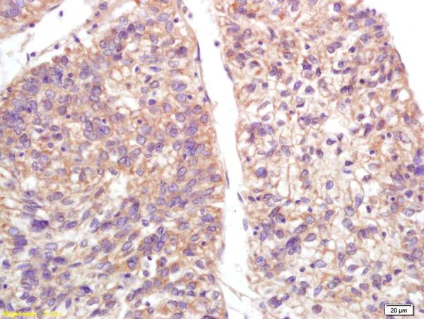 Immunohistochemistry (Formalin/PFA-fixed paraffin-embedded sections) - Anti-S100A9 antibody (AB203133)