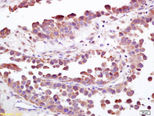 Immunohistochemistry (Formalin/PFA-fixed paraffin-embedded sections) - Anti-S100A9 antibody (AB203133), expandable thumbnail