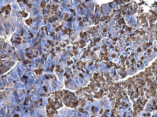 Immunohistochemistry (Formalin/PFA-fixed paraffin-embedded sections) - Anti-S100A9 antibody (AB227924), expandable thumbnail