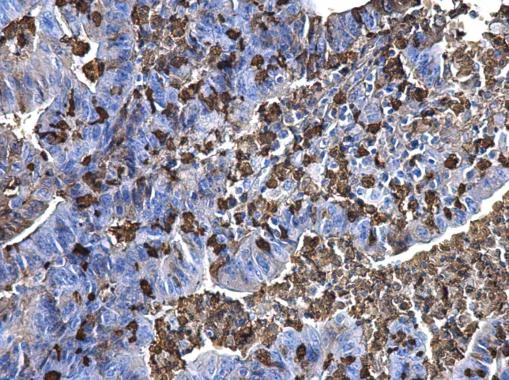 Immunohistochemistry (Formalin/PFA-fixed paraffin-embedded sections) - Anti-S100A9 antibody (AB227924)